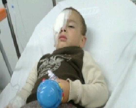 Menino de 3 anos teve o olho perfurado por um gancho, em Petrópolis. (Foto: Arquivo pessoal)
