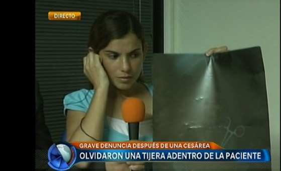 Médicos esqueceram pinça hemostática no corpo da argentina Clara Nicolasa Avila