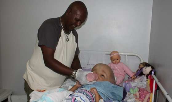 Claudemir cuida sozinho da filha com hidrocefalia