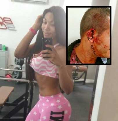 A travesti Verônica Alves arrancou orelha de PM e levou uma surra de policiais