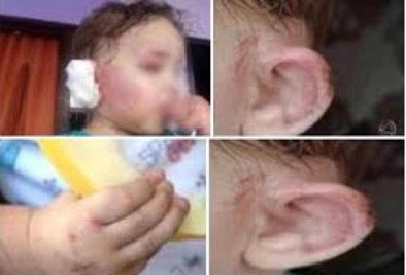orelha