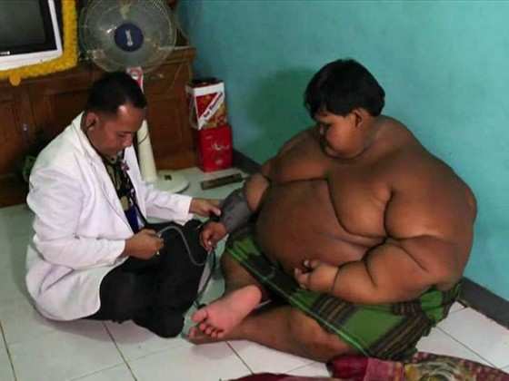 Arya Permana é considerado obeso mórbido