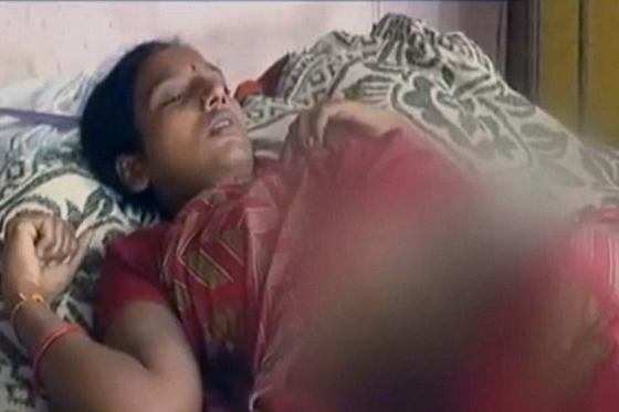 Girija, como foi identificada a jovem, de 27 anos, foi levada para o hospital com queimaduras graves em 30% do corpo.