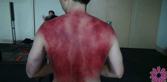 Paciente tratado com violência pelo 'curandeiro' chinês 