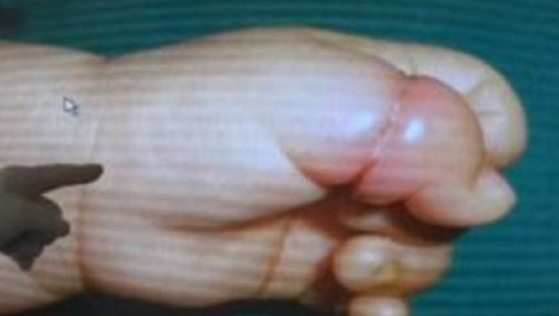 O bebê ficou com o cabelo da mãe enrolado em seu dedo por muitos dias.