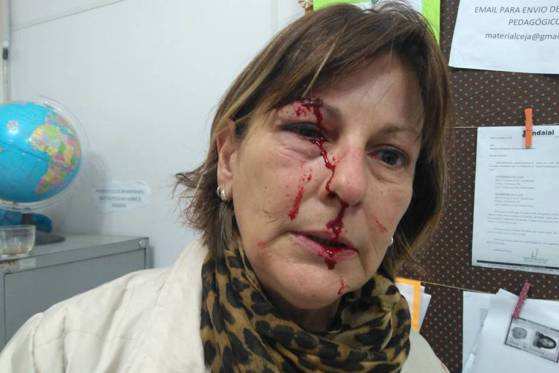 Márcia Friggi, professora da rede pública de ensino que foi agredida dentro da escola em Santa Catarina