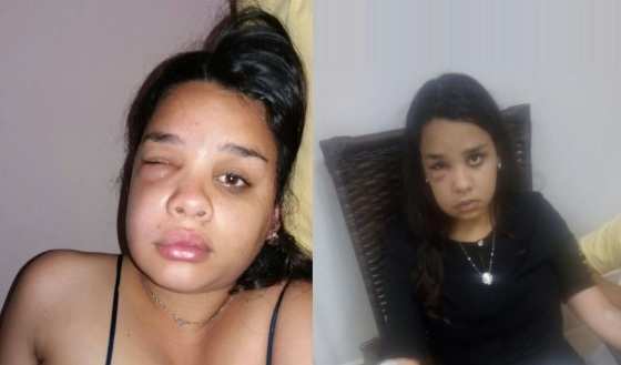 Maria Clara retornou à clínica em busca de ajuda, mas foi orientada a procurar uma UPA e tomar uma Benzetacil.