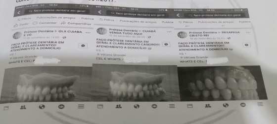 Falso protético atuava nas redes sociais e nas casas de clientes