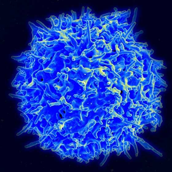 Na imagem, o Linfócito T. Na terapia genética, cientistas modificam essa célula de defesa para que ela aprenda a combater o tumor