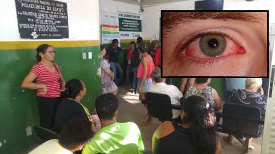 Casos de conjuntivite em Cuiabá e Várzea Grande aumentaram consideravelmente em dezembro
