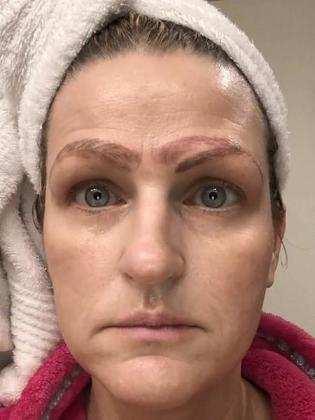 Mulher fica com quatro sobrancelhas após realizar procedimento estético