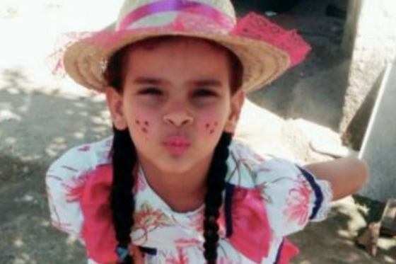 Ana Cristina Pacheco Luciano, de nove anos de idade, que teve 80% do corpo queimado