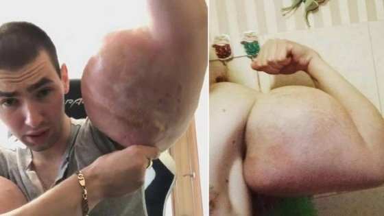 Kirill Tereshin, mais conhecido como 'Popeye russo'