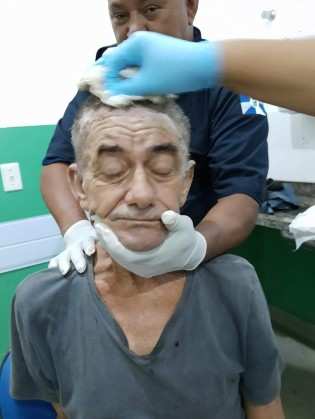 Morador de rua estava com larvas na cabeça e teve o cabelo raspada para tratamento na UPA de Peruíbe (SP) 