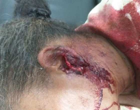 A vítima foi socorrida e levada ao hospital para atendimento.