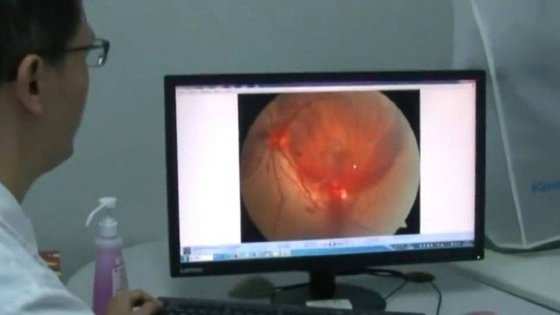 Excesso de uso de smartphone provocou derrame em retina de paciente na China