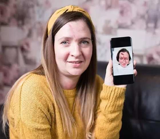 Após a cirurgia, Flynn foi encaminhada ao Hospital Christie no mesmo dia para uma reconstrução facial.