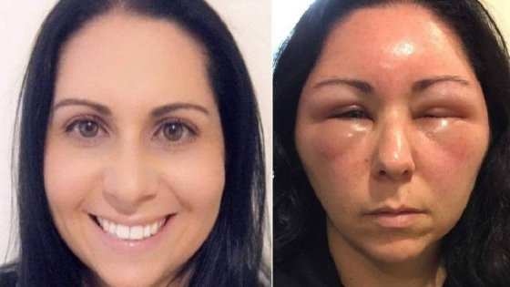 Julie antes e depois da aplicação da tintura de cabelo