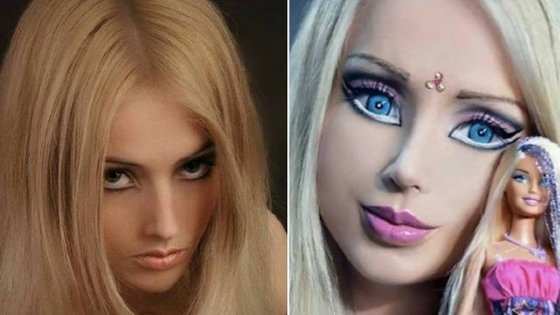 aleria (atualmente) e nos tempos de 'Barbie humana'