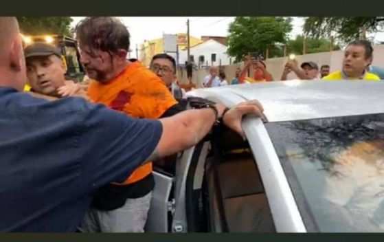 O senador licenciado deixou a UTI, mas segue internado no hospital