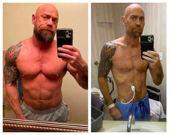 O enfermeiro Mike Schultz antes e depois de ser diagnosticado com COVID-19