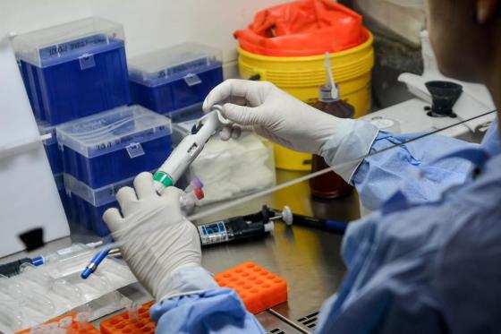 Foram notificadas 27 novas confirmações de casos de coronavírus no Estado