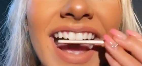 Dentistas alertam sobre os danos que a técnica de DIY pode causar