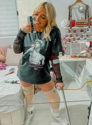 Letícia Fabbri, de 26 anos, é moradora de São Paulo e teve os pés amputados em 2018 devido a uma pneumonia bacteriana que se agravou. Ela recebeu próteses de um empresário de Sorocaba (SP).