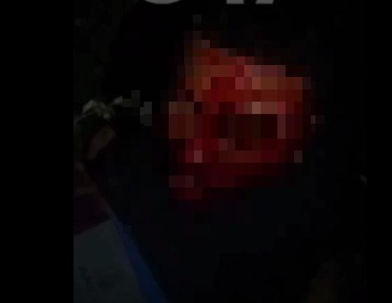 Homem ainda estava vivo quando começou a ser decapitado.