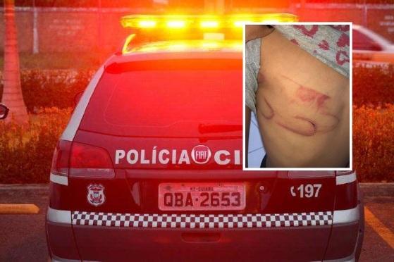Crianças foram espancadas pelo pai e pela madrasta