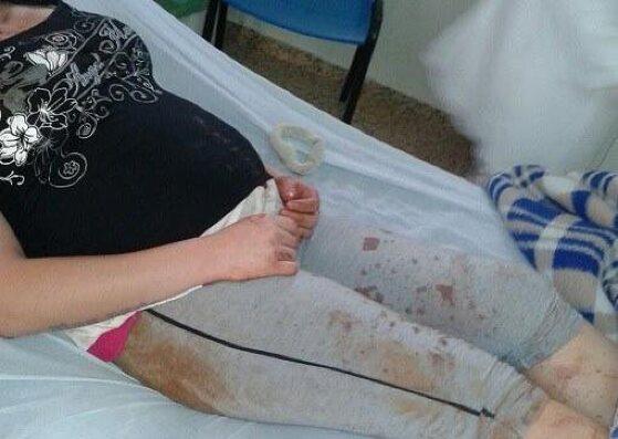 Mulher é socorrida após ser espancada pelo ex-marido