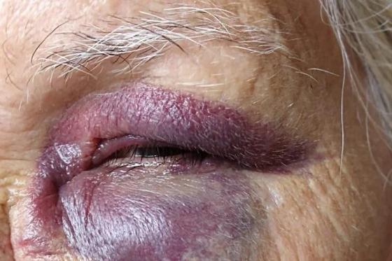 Homem agrediu mãe idosa com soco no rosto