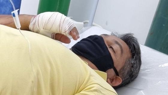 Prefeito Jamis Silva Bolandin teve lesão na mão direita.