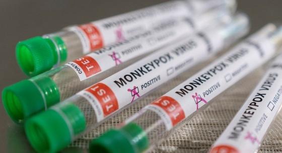 MT confirmou 114 casos de Monkeypox