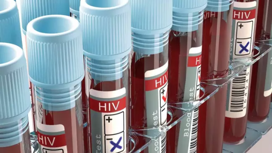 Pesquisadores utilizaram técnica similar àquela utilizada para criar as vacinas contra a covid-19… - Veja mais em https://www.uol.com.br/vivabem/noticias/redacao/2025/08/27/80-de-vacinados-contra-o-hiv-em-novo-teste-produzem-anticorpos-diz-estudo.htm