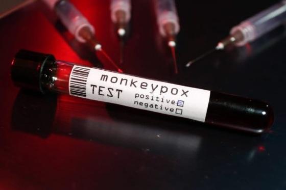O Laboratório Inac disponibilizou um novo teste que consegue detectar a infecção do vírus da varíola dos macacos -Monkeypox.
