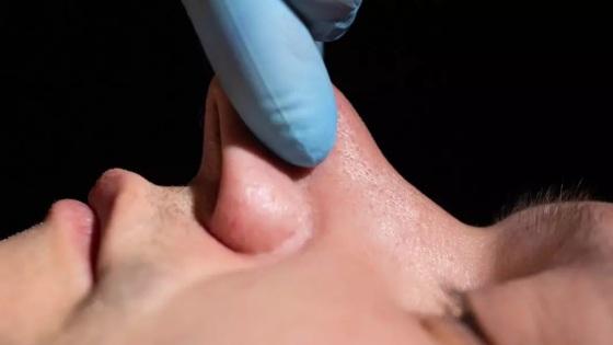 O jovem  procurou ajuda médica porque ficou com medo da cirurgia infeccionar.