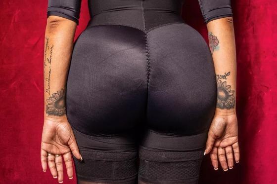Conhecido como ‘levantamento de bunda brasileiro’, cirurgia ganha adeptos nos Estados Unidos