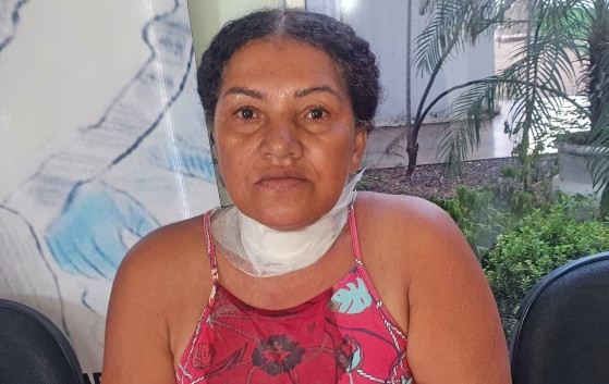 Mulher teve pescoço cortado por linha de pipa com cerol