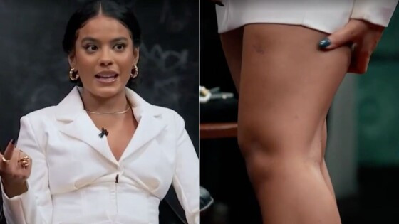 Atriz cuiabana foi mordida por jacaré durante filmagens de "Pantanal"