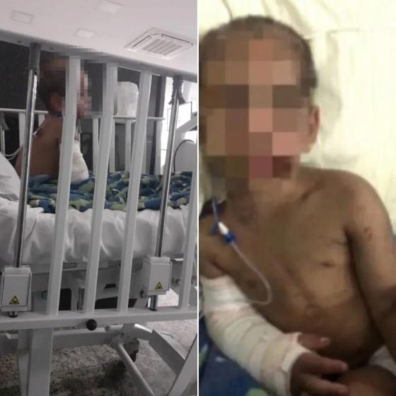  O menino de quatro anos que foi brutalmente agredido pela mãe e pelo padrasto em São Vicente, no litoral de São Paulo 