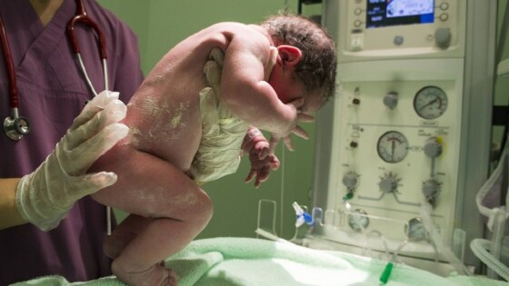 O bebê nasceu de parto normal após 36 semanas de gestação