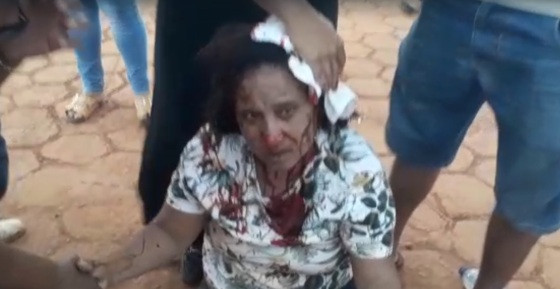 Mulher ficou ferida após ser atingida por estrutura metálica.