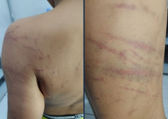 Os agentes constataram diversos ferimentos pelo corpo do menor.