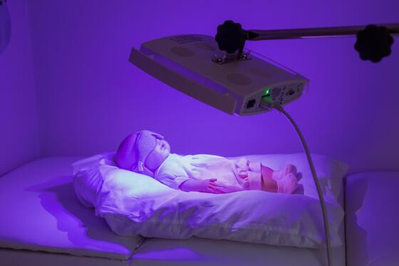  A fototerapia é um tratamento para icterícia neonatal.