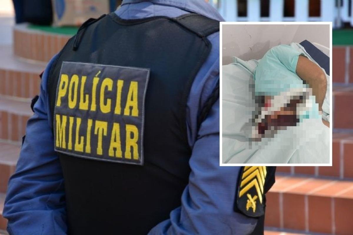 Bandido Crava Faca Nas Costas De Policial Militar E Morre Baleado Em Mt