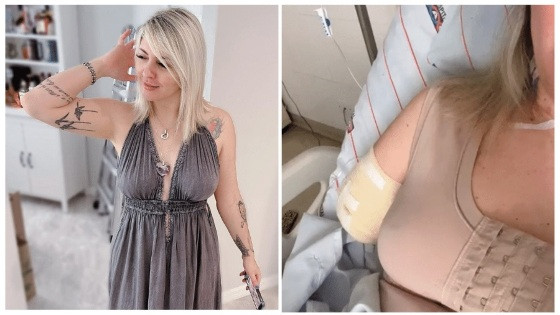A tatuadora Camila, 41, teve o braço direito amputado até a altura do cotovelo.
