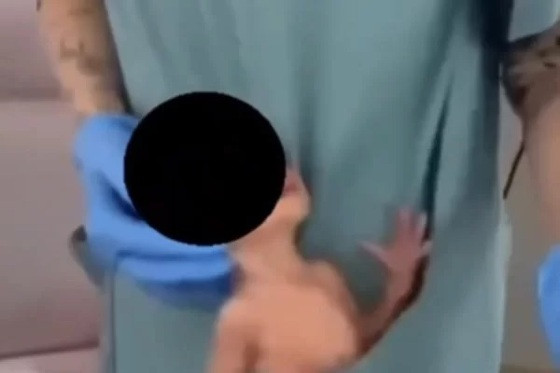 Recém-nascido é chacoalhado no bolso de funcionária de hospital em SC durante dança