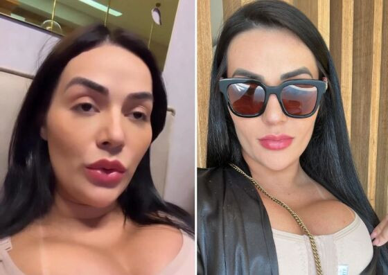 Carla já recebeu alta. 
