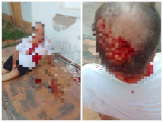 Agressão teria sido feita por assessor de Lúdio